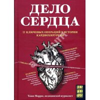 Справа серця . 11 ключових операцій в історії кардіохірургії 